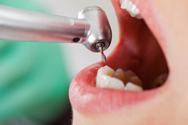 Best Emergency Gum Treatment in Pagedale, MO